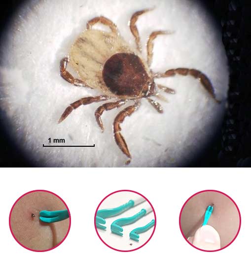 Tick Twister® TRIO do usuwania kleszczy - kleszczołapki® dla zwierząt i ludzi